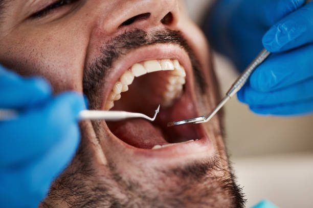 Best Dentist for Tooth Abscess  in West New York, NJ